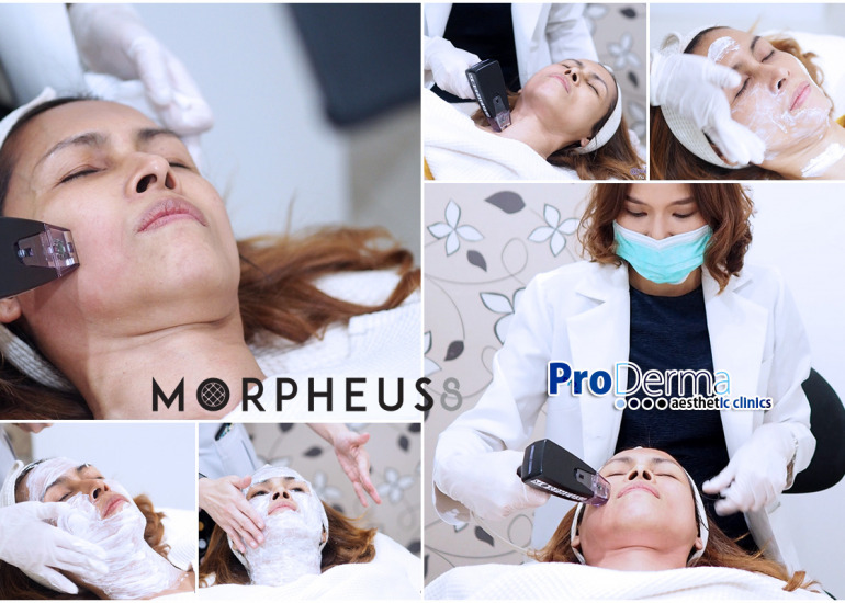 รีวิว Morpheus 8 ยกกระชับผิว