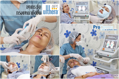 Ulthera SPT ที่ไหนดี : Proderma คลีนิก
