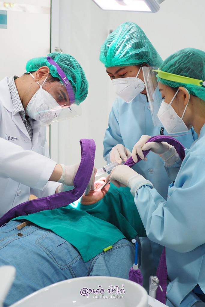 รีวิว ทำรากฟันเทียม หมอ บอน VP Dental Clinic รีวิว by ลุงเด้ง ป้าไก่