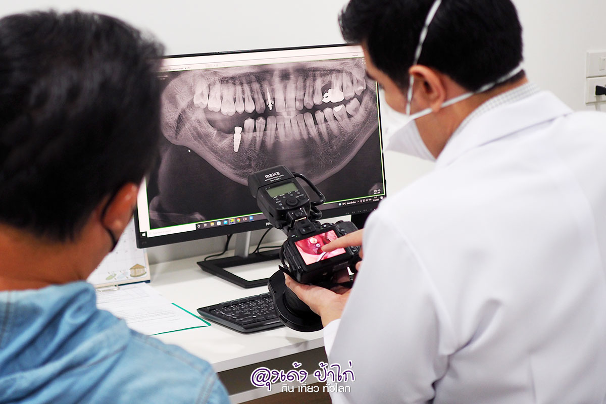 รีวิว ทำรากฟันเทียม หมอ บอน VP Dental Clinic รีวิว by ลุงเด้ง ป้าไก่