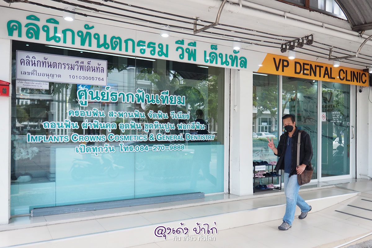 รีวิว ทำรากฟันเทียม หมอ บอน VP Dental Clinic รีวิว by ลุงเด้ง ป้าไก่